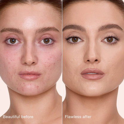Charlotte Tilbury Airbrush Flawless Crease-Proof Long-Wear Blur Concealer with Hyaluronic Acid
